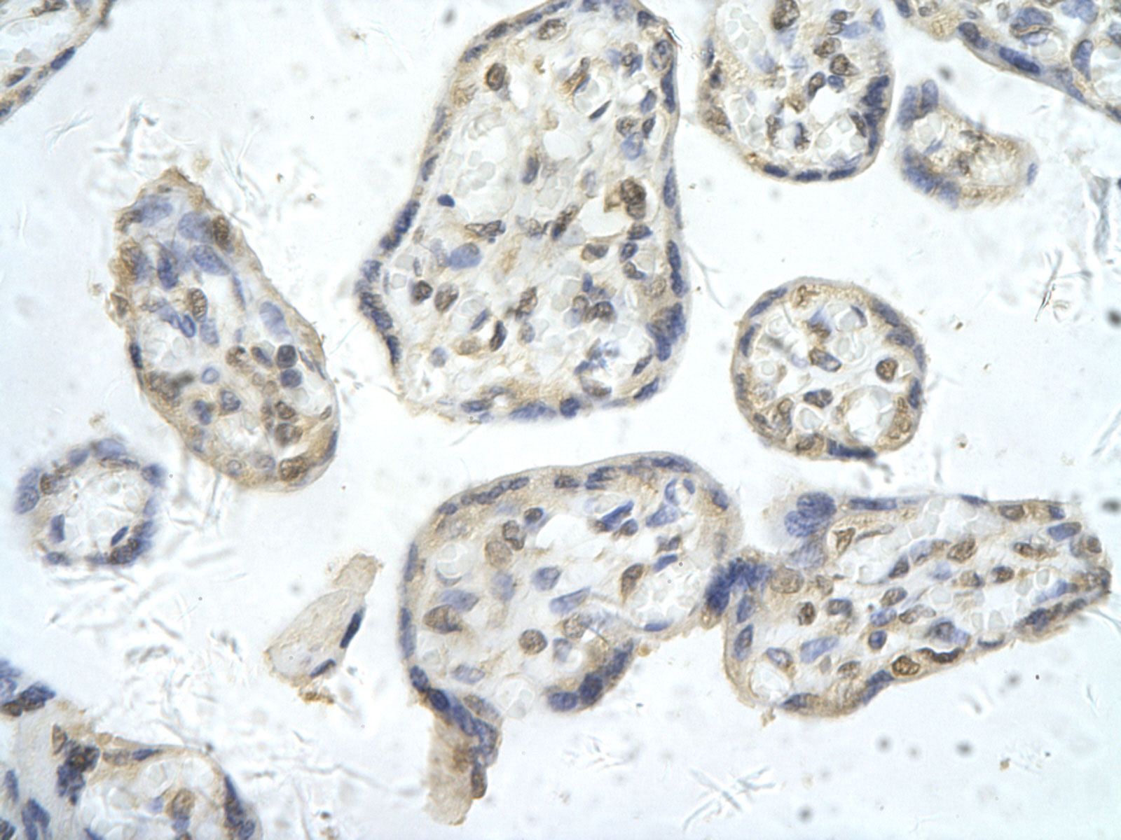 2 - PPARD antibody - N-terminal region AI11457