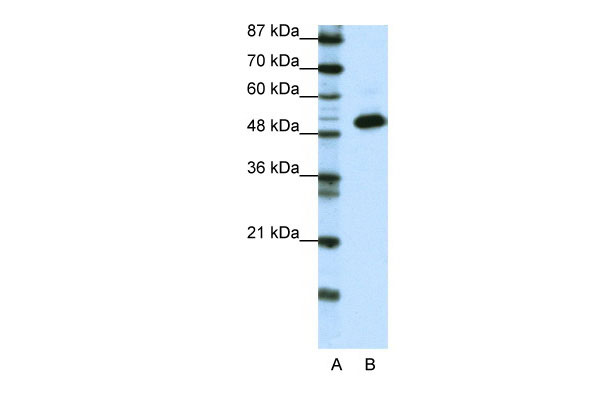 1 - TADA3L antibody - N-terminal region AI11461