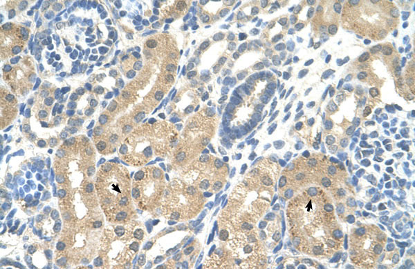 2 - KHK antibody - C-terminal region AI11883