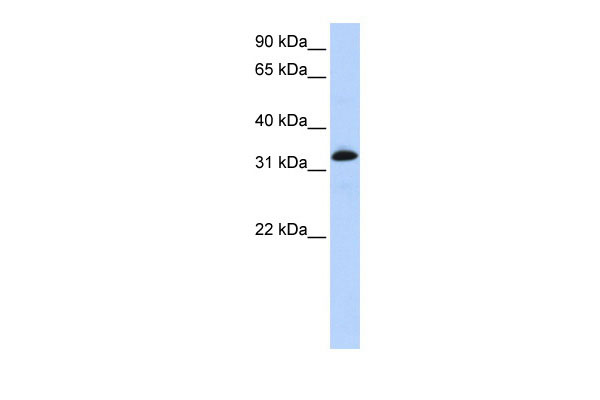 1 - TNNT2 antibody - N-terminal region AI11931