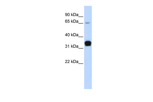 1 - TNNT1 antibody - middle region AI11978