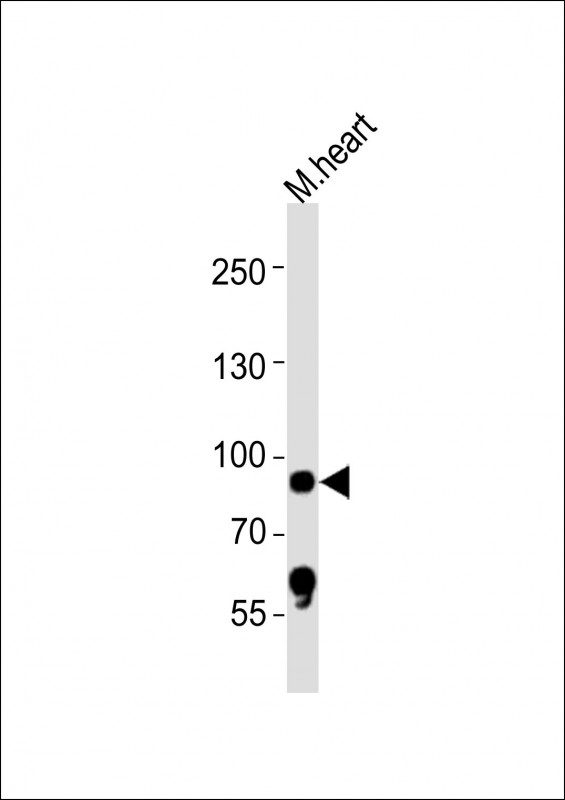1 - Mouse Rps6ka5 Antibody (C-term) AP21376b