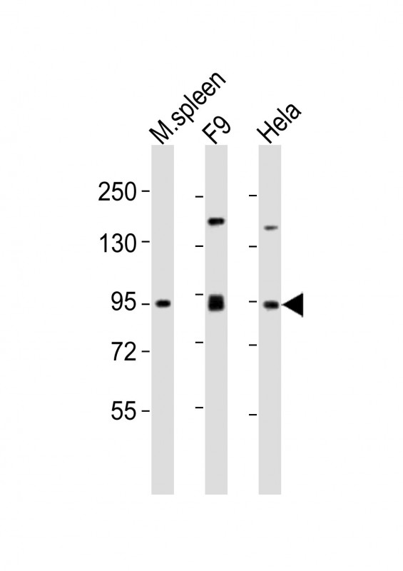 1 - SUZ12 Antibody (Center) AP21396c