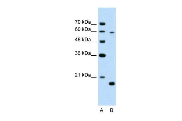 1 - SLC38A4 antibody - middle region AI12110
