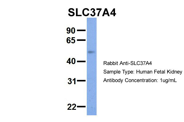 1 - SLC37A4 antibody - middle region AI12325