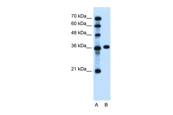 1 - PTCH1 antibody - C-terminal region AI12396