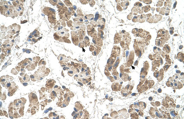 2 - SSR2 antibody - N-terminal region AI12577