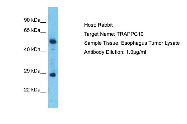 1 - TRAPPC10 Antibody - C-terminal region AI12619