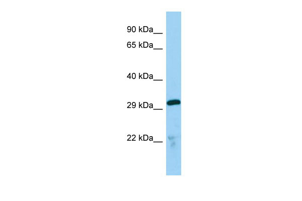 1 - Tmx2 Antibody - C-terminal region AI12757