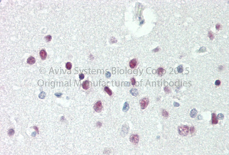 2 - TBX15 antibody - C-terminal region AI12836