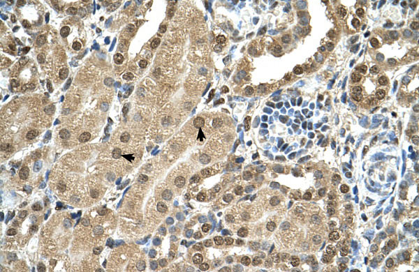 2 - TBX15 antibody - C-terminal region AI12836