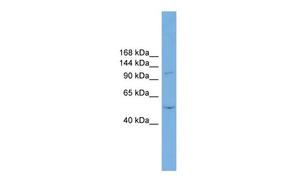 1 - TNNI3K antibody - N-terminal region AI12868