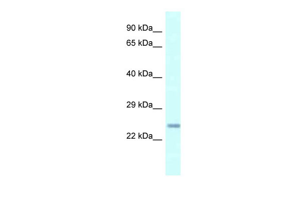 1 - Cdkn3 antibody - N-terminal region AI13589