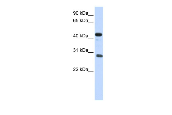 1 - CDCA5 antibody - middle region AI14271