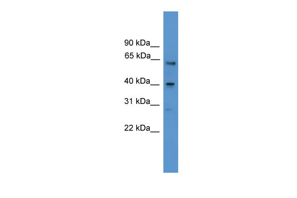 1 - SSTR2 antibody - middle region AI14422