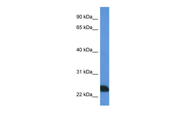 1 - PRSS1 antibody - N-terminal region AI14595