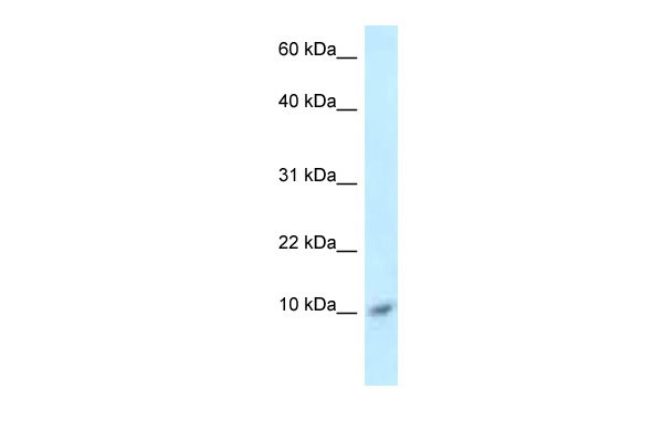 1 - S100A8 antibody - middle region AI14662