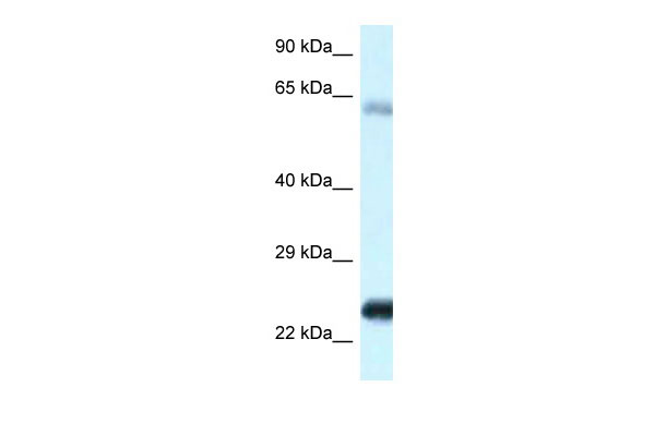 1 - NDUFS8 antibody - C-terminal region AI14728