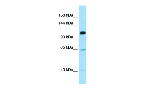 1 - SMC6 Antibody - C-terminal region AI15058
