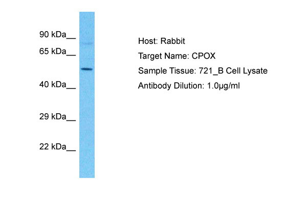 1 - CPOX Antibody - C-terminal region AI15175