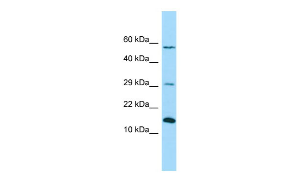 1 - NDUFB4 Antibody - C-terminal region AI15401