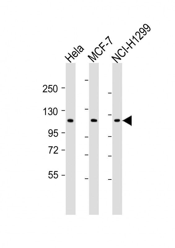 1 - PPP1R13L Antibody (Center) AP21505c