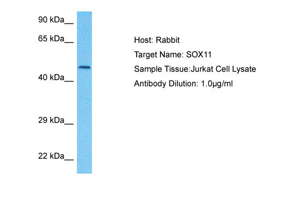1 - SOX11 Antibody - N-terminal region AI16130
