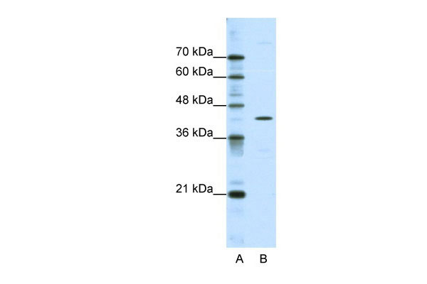 1 - DOK2 antibody - C-terminal region AI16194