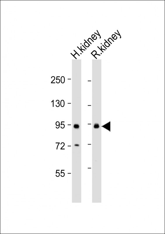 1 - SLC26A4 Antibody (C-Term) AP21644b