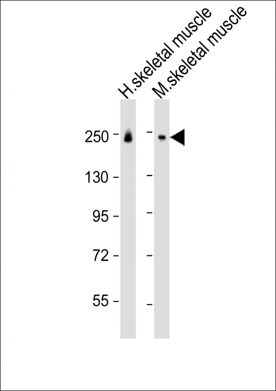 1 - MYH8 Antibody (N-Term) AP21714a