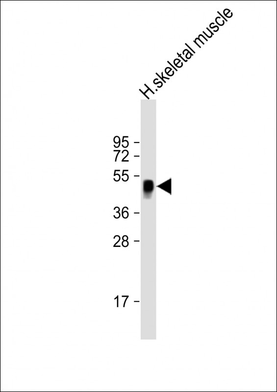 1 - WNT11 Antibody (Center) AP21715c