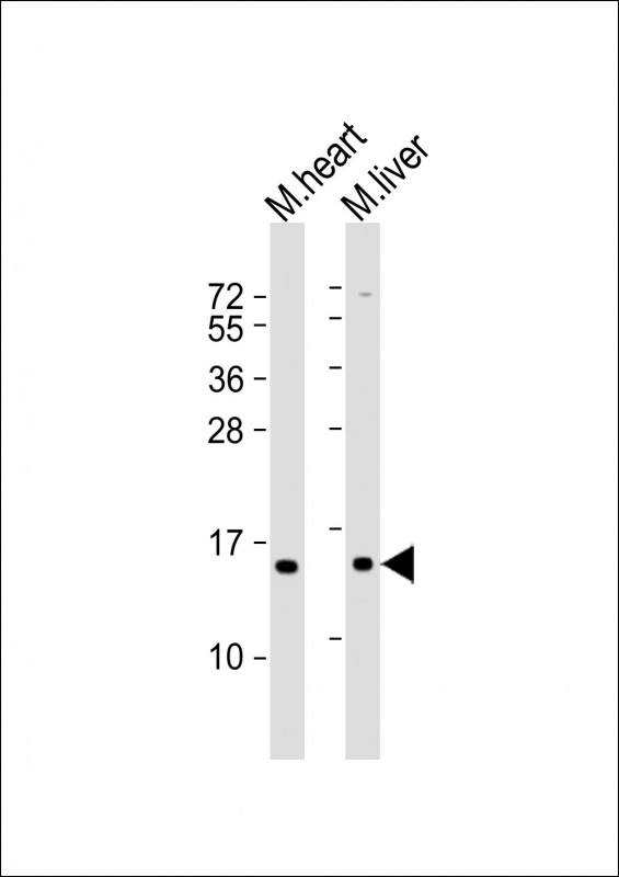 1 - NDUFA7 Antibody (N-Term) AP21716a