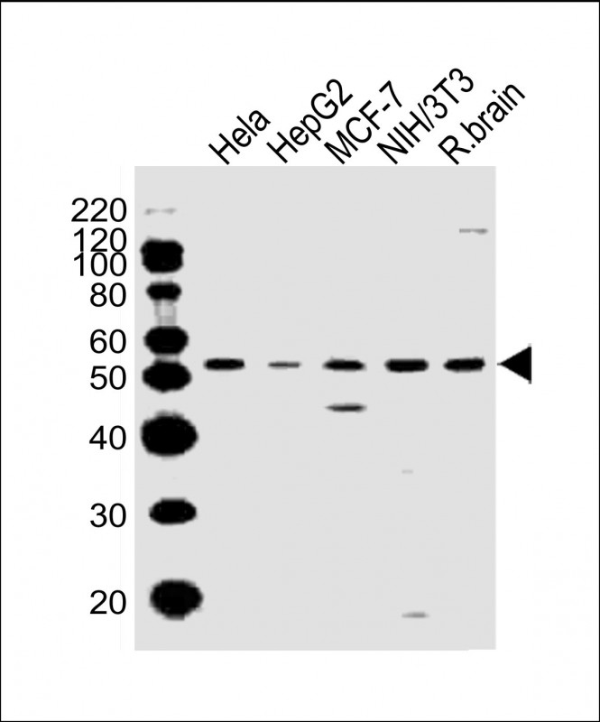 1 - PPP2R2A Antibody (N-term) AW5520