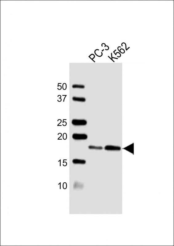1 - VAMP4 Antibody (Center) AW5523