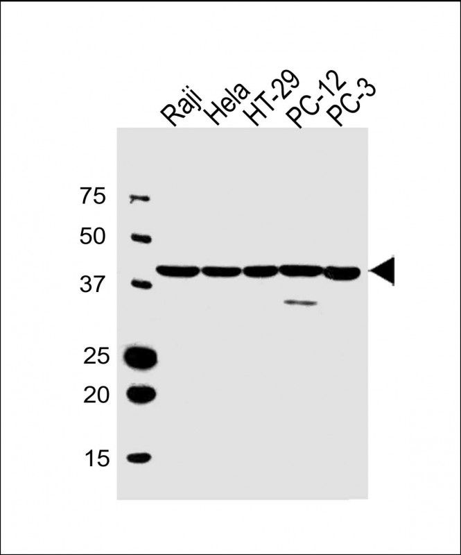 1 - VPS37C Antibody (Center) AW5543