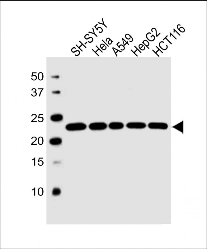 1 - RPL9 Antibody (C-term) AW5553