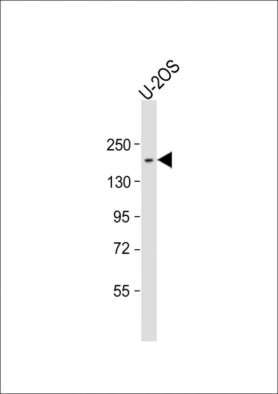 1 - NCOA2 Antibody (C-Term) AP21793b