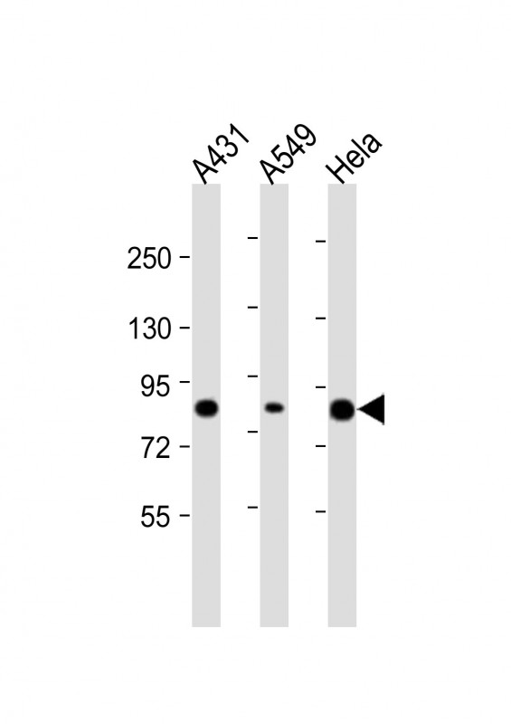 1 - PLA2G4D Antibody (C-Term) AP21807b