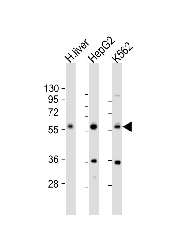 1 - NAGS Antibody (Center) AP21812c