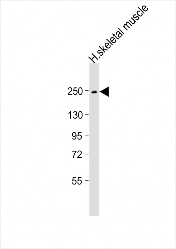 1 - MYH4 Antibody (N-Term) AP21817a