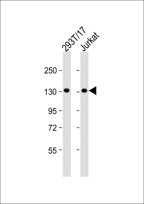 1 - PUR4 Antibody  (N-term) AP4751a