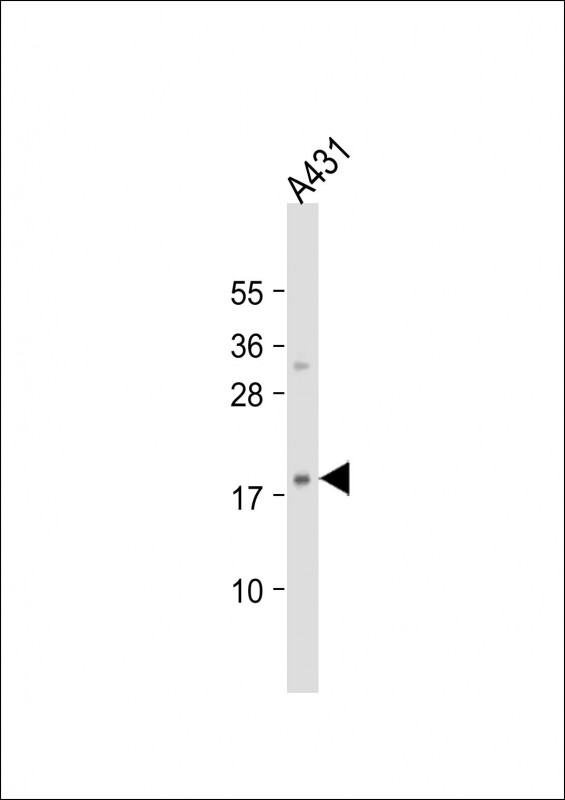 1 - H3f3b Antibody (Center) AP21845c