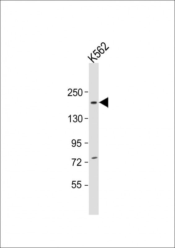 1 - NCOA2 Antibody (Center) AP21855c