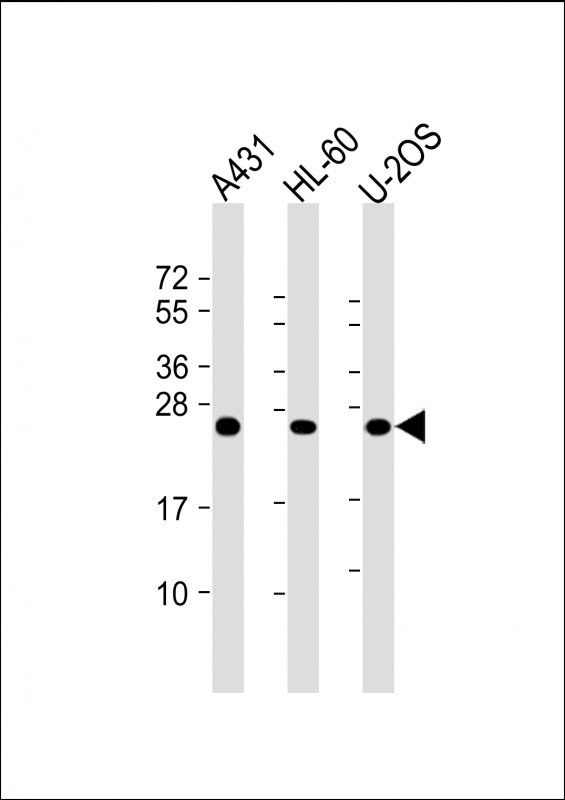 1 - RAB5C Antibody AM8520b