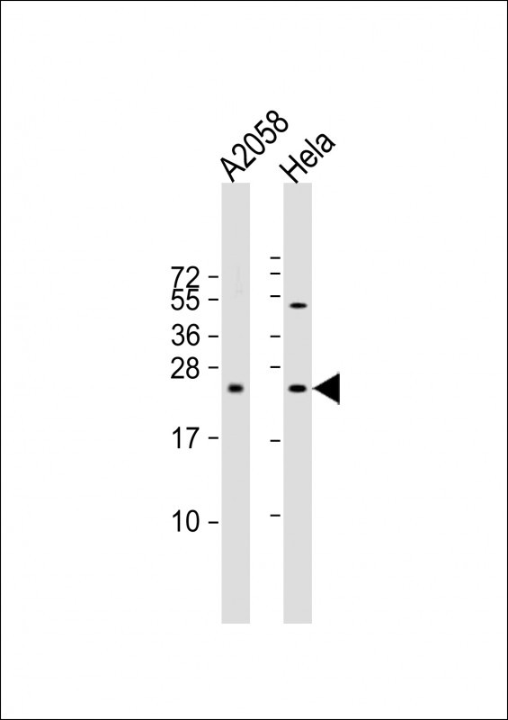 1 - SDHD Antibody (N-term) AP12155a