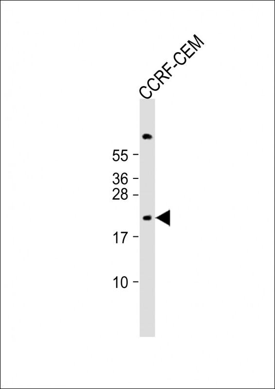 1 - FXN Antibody (N-term) AP19965A