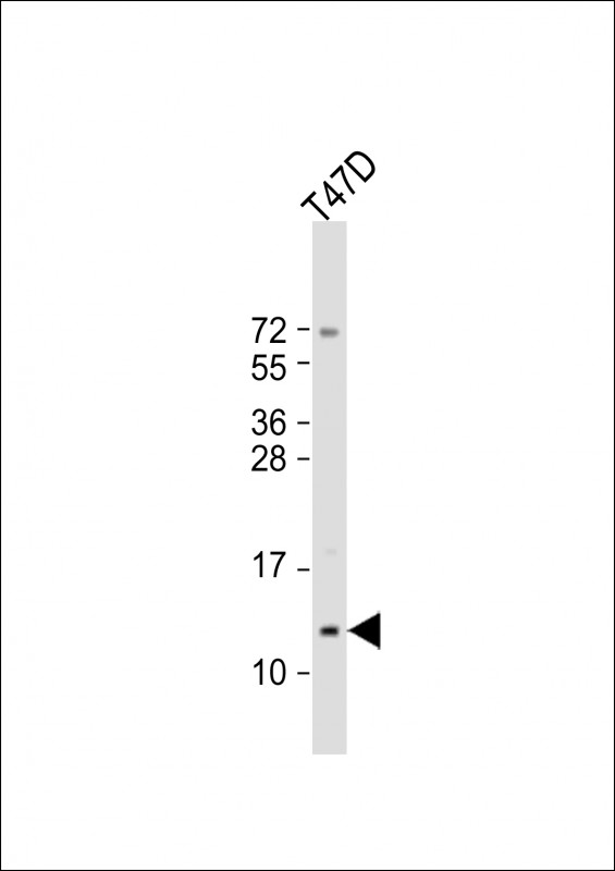 1 - SCGB2A2 Antibody (N-Term) AP21959a