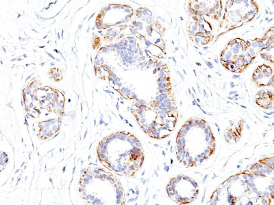 2 -  Smooth Muscle Myosin Heavy Chain (SM-MHC) (Leiomyosarcoma & Myoepithelial Cell Marker) Antibody - W AH11944