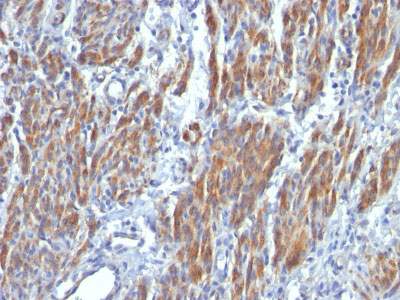 2 -  Smooth Muscle Myosin Heavy Chain (SM-MHC) (Leiomyosarcoma & Myoepithelial Cell Marker) Antibody - W AH11944