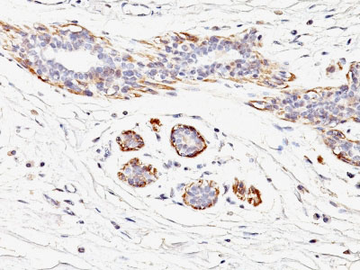 2 -  Smooth Muscle Myosin Heavy Chain (SM-MHC) (Leiomyosarcoma & Myoepithelial Cell Marker) Antibody - W AH11953